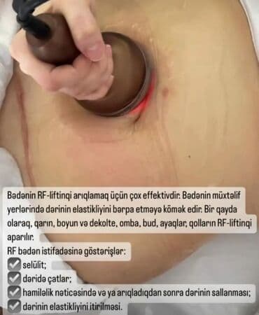 qadın xəstəlikləri: Müalicəvi masaj, Kişilər üçün, Qadınlar üçün, Uşaqlar üçün, Klinikada — 4