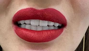 Услуги: Diş texnikliyi kursları(6 ay erzinde tam öyredilir, stomotoloji — 6