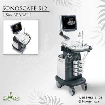 sederek tibbi avadanlıqlar: UZİ aparatı, Tibbi aparatlar — 1