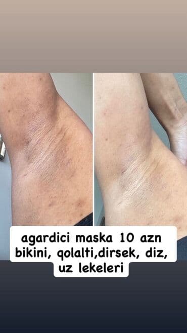 маска ламинария от пигментных пятен: Крем для лица, Для всех типов кожи, Новый, Бесплатная доставка — 2