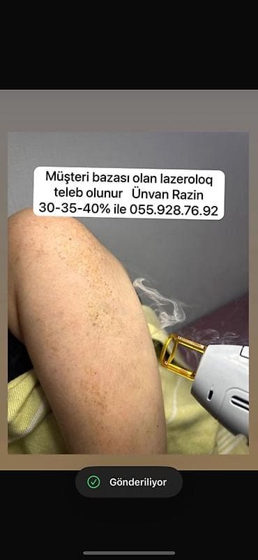 Lazer ustası tələb olunur, Faiz