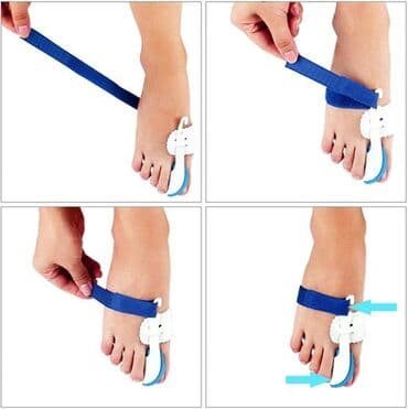 Tibbi geyim: Barmaq duzelden Barmaq duzleşdirici Fiksator-korrektor, baş barmağın — 2