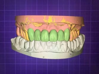 qaynaq saclarin qiymeti: Услуга зубного техника и зуботехнической лаборатории выполняю все — 5