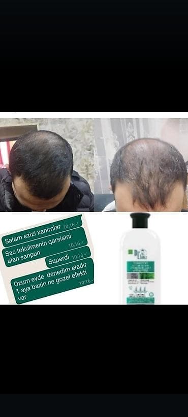 доска садху купить баку: Nəticəsi göz qabağında super məhsul — 1