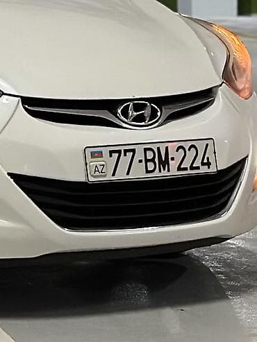 3 e30: Hyundai Elantra 2015 – qara reng ön bamfon tortu 3 xrom zolaqlı — 2