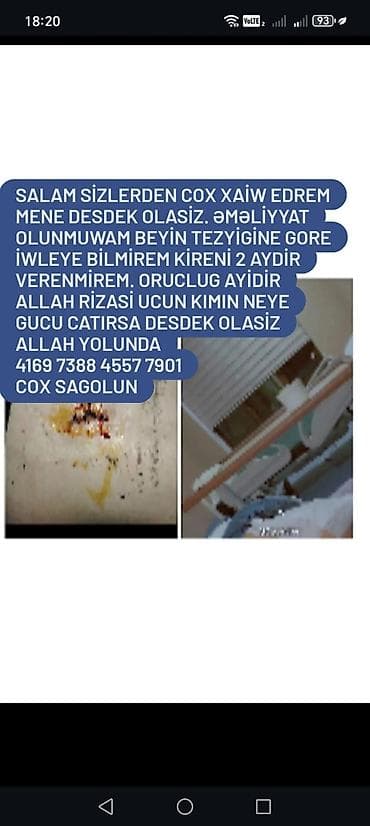 Dostlar xaiş edirem desdek Olasınız