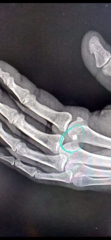 qaçış aparatı satış: Şəhər üçün böyük təkərli skuter - Rəng: ağ, qara detallarla - — 5