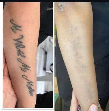 qaş formaları 2022: Salam.Qas Permanent,Microblading,Tatu yazilmasi ve silinmesi,Sac — 5