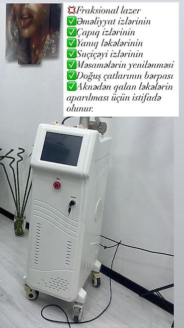 lazerli printer: Zəmanətlə — 1