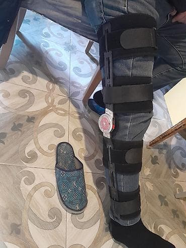 tib: Tənzimlənən diz ortozu (knee brace) – sərt yan şinli model cox az — 1