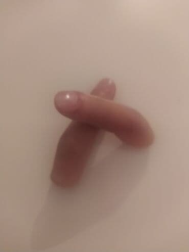 oksigen balonu icin reduktor: Turkiyenin "REHA The Art of Prosthetics" klinikasinda duzeldilib, Sol — 2