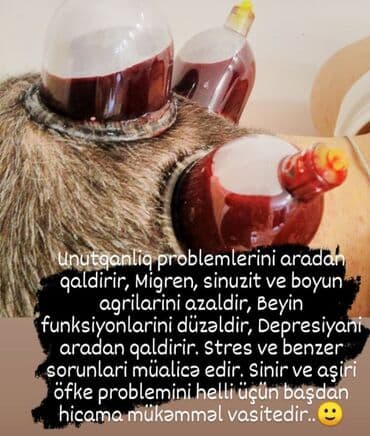 Hicamanın Faydaları✅ *Qan dövranın pozulması *Qanın təmizlənməsi lalafo.az -da Hicamanın Faydaları✅ *Qan dövranın pozulması *Qanın təmizlənməsi