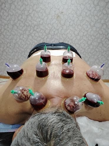 Şimal bölgələrində Hicama zəli, bioenerji masajı xidməti göstəririk