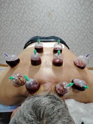 Ручная работа на заказ: Şimal bölgələrində Hicama zəli, bioenerji masajı xidməti göstəririk — 1