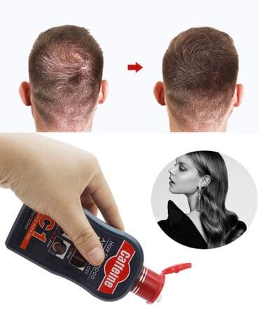 homm bitkisel az: Saç tökülməyinə qarşı
Saç gətirən şampun — 3