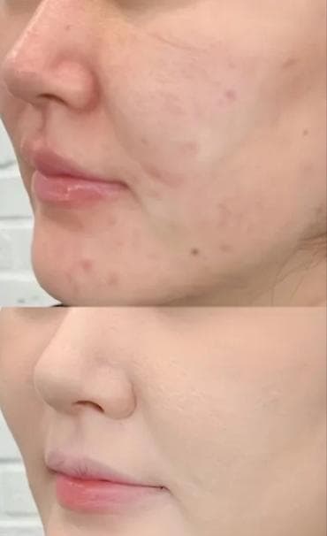 tonika nece istifade olunur: Üz kremi — 1