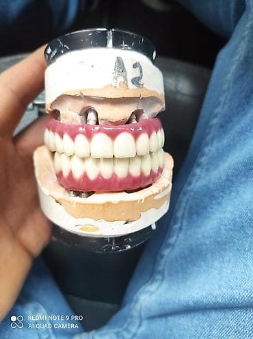 Услуги: Diş texnikliyi kursları(6 ay erzinde tam öyredilir, stomotoloji — 4
