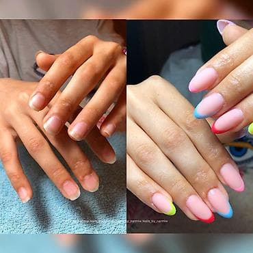 Digər xidmətlər: Hər növ dırnaq qaynagı münasib qiymətə. Unvan sabuncu xestexanasinin — 6