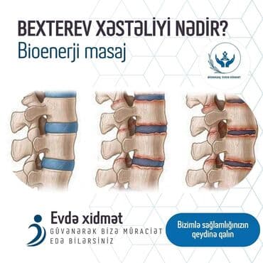 masaj xidməti 2021: Müalicəvi masaj, Uşaqlar üçün, Evə gəlməklə, Klinikada — 8