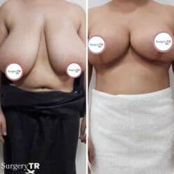 qarin eritmek ucun krem: Estetik–plastik cərrahiyyə və bədən formalaşdırma xidmətləri Təklif — 19