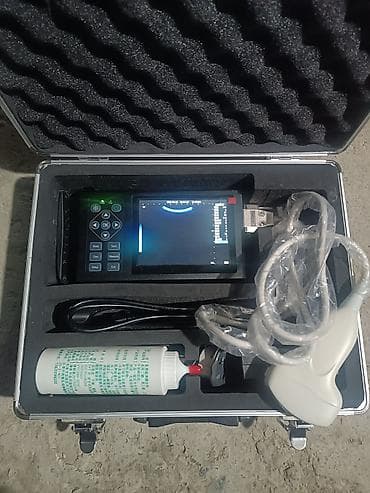 Tibbi avadanlıq: Daşınan ultrasəs diaqnostika cihazı (portable USG) Xüsusiyyətlər: - — 4