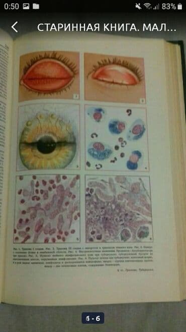 большая медицинская энциклопедия: Старинная книга 
малая медицинская энциклопедия 
1968г. Том 10 — 3