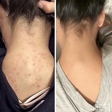 Кремы и сыворотки для лица — 1