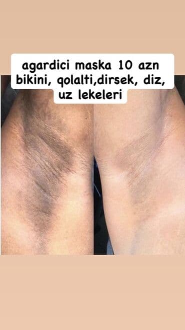 маска ламинария от пигментных пятен: Крем для лица, Для всех типов кожи, Новый, Бесплатная доставка — 5