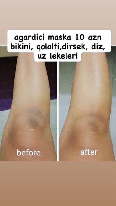 маска ламинария от пигментных пятен: Крем для лица, Для всех типов кожи, Новый, Бесплатная доставка — 3