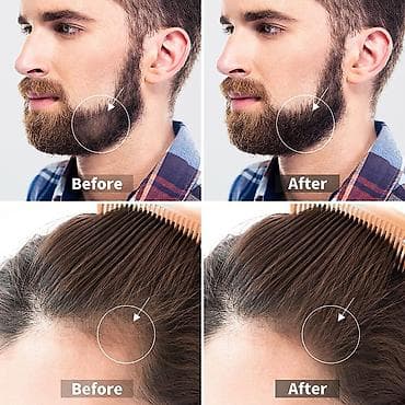 Kosmetika: Üz üçün masajor, roller, Yeni, Rayonlara çatdırılma — 4