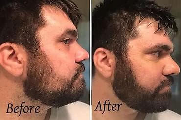 Bədənə qulluq: Üz üçün masajor, roller — 2