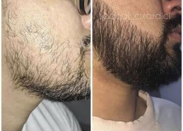 qaş və kirpiklər üçün baxım: Məhsul: Beard Oil – 100% natural/organic, 30 ml Təsvir: - Saqqal və — 3