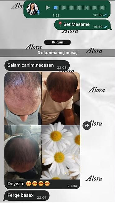 baş: Saç tökülməsinə qarşı bitki tərkibli qulluq dəsti - Məqsəd — 1