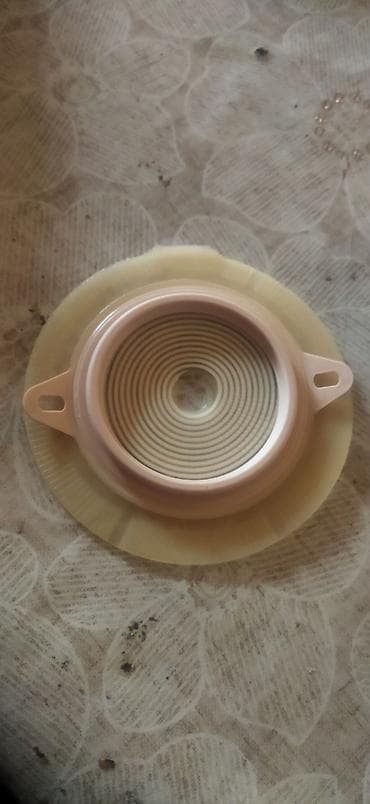 Kolostomiya/Urostomiya üçün iki hissəli stoma sistemi sidik torbası