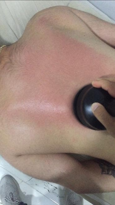 masaj: Skolioz masajı, Böyüklər üçün, Klinikada — 3