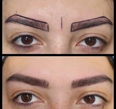 qısa saç modelləri: Seyrek formasiz qaslarin mikrobledinqle berpasi — 4