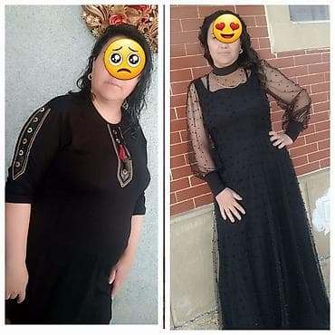 gozelik salon: Xidmət: fərdi arıqlama və bədənformalaşdırma proqramı Təsvir: - Foto — 1