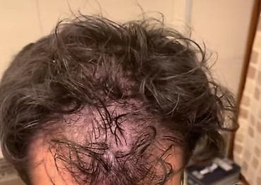 at quyrugu: EMBEAUTY 9 Aktivli – Dökülən və gec uzayan saçlar üçün dolğunlaşdırıcı — 2