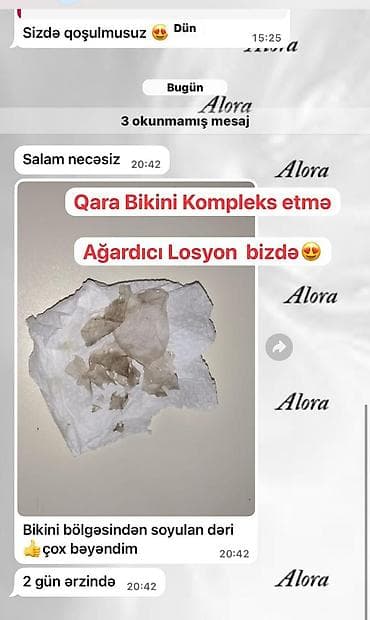 ucuz etir: ✨ QOLTUQALTI • BİKİNİ • DİZ • DİRSƏK ÜÇÜN AĞARDICI LOSYON ✨ — 3