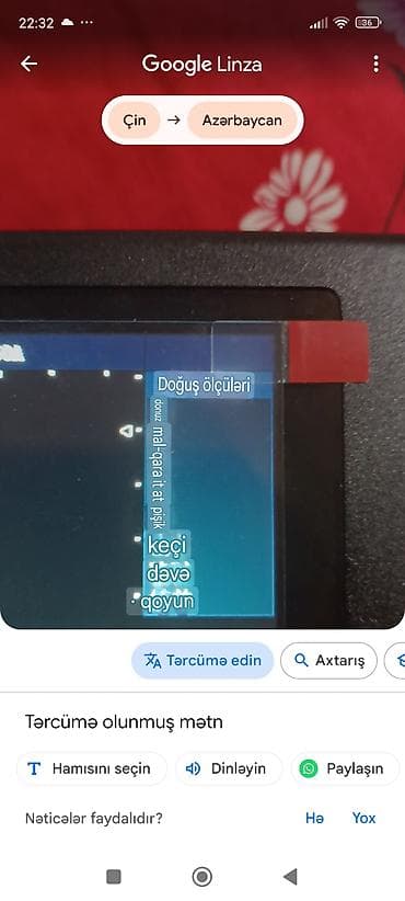 Tibbi avadanlıq: Rəqəmsal ultrasəs/USG görüntüləmə cihazı üçün portativ monitor və — 1