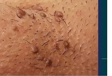 masaj bakida evde: Klassik masaj, Kişilər üçün — 4