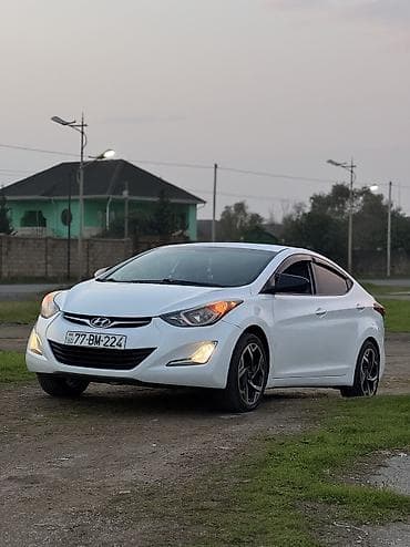 3 e30: Hyundai Elantra 2015 – qara reng ön bamfon tortu 3 xrom zolaqlı — 3