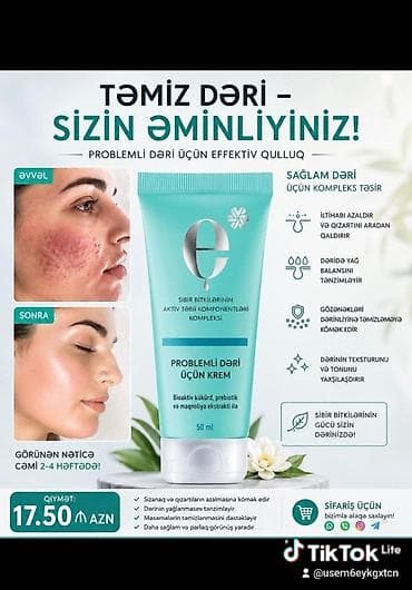 acnelyse 0.1: Üz baxımı üçün məhsul dəsti – SPF qoruması, qidalandırıcı qulluq və — 3