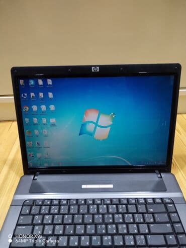 Notbuk satılır qiymətindən çox aşağı işlək vəziyyədədi. Üstündə — 1