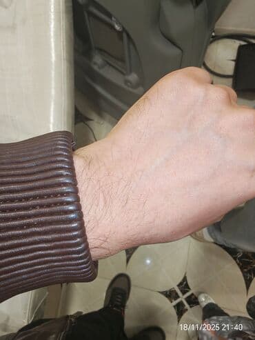 ilizarov aparatı qiymeti: Epilyasiya üçün, Aleksandrit, Təlim keçirilir — 4