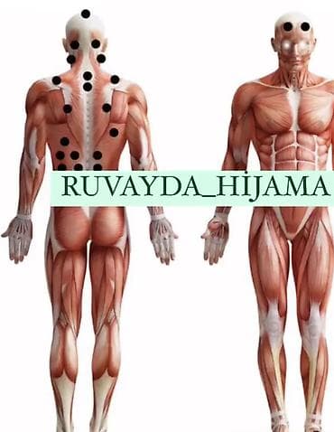 taxta qapi sekilleri: Xidmət: Hijama (qansorma) – vakuum bankalarla terapevtik prosedur — 2