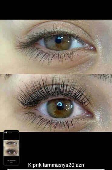 приглашаю на наращивание ресниц: ELIT lazer studio Pesakar lazeroloqlar xidmetinizde.Yeni endirimler — 2