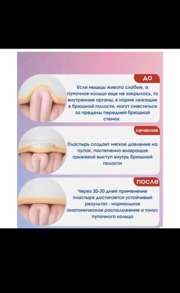 uşaqlar üçün 3d pazllar: Пластырь от пупочной грыжи . Покупалось малышу быстро помог — 4