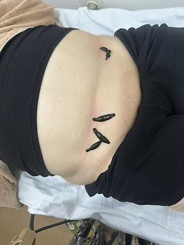 Красота и здоровье: Hirudoterapiya və Hicama (Qan çıxarma) xidməti - Hirudoterapiya — 1