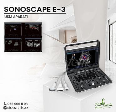USM aparatı, Portativ uzi aparatı SONOSCAPE E3 Yeni portativ
